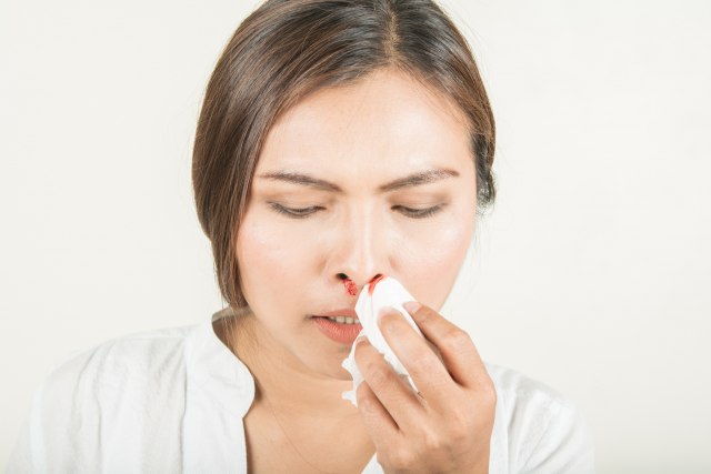 Šta sve može da bude uzrok krvarenja iz nosa?